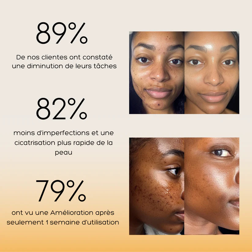 Sérum Anti-Imperfections 3 en 1