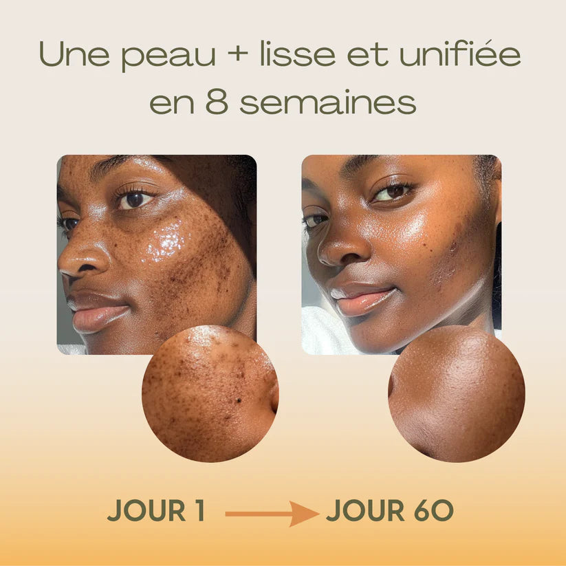 Sérum Anti-Imperfections 3 en 1