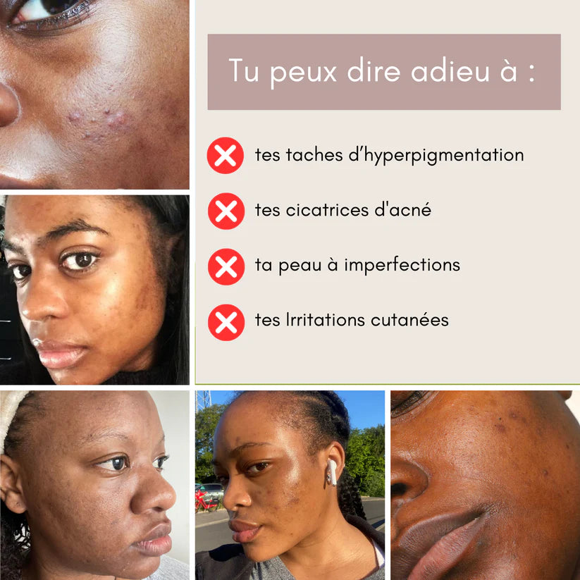 Sérum Anti-Imperfections 3 en 1