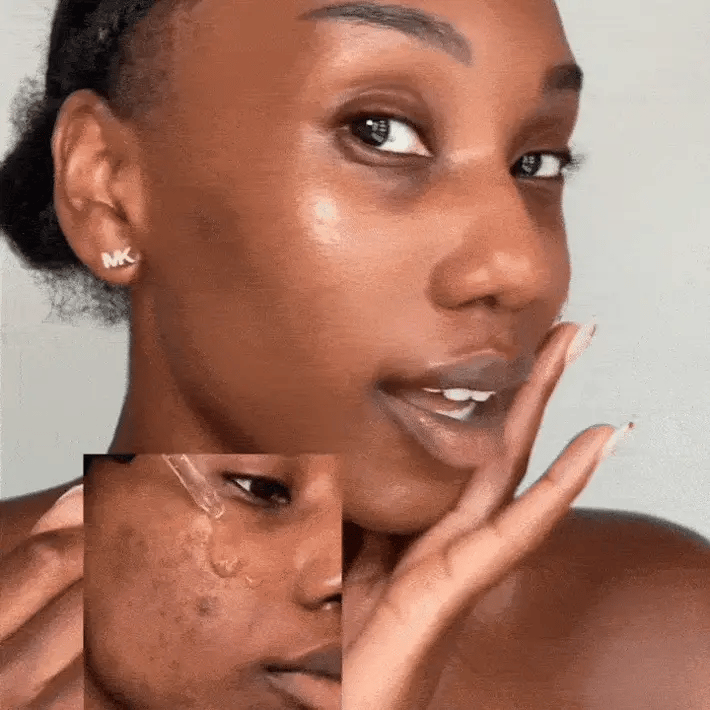 Anti-Blemish Routine