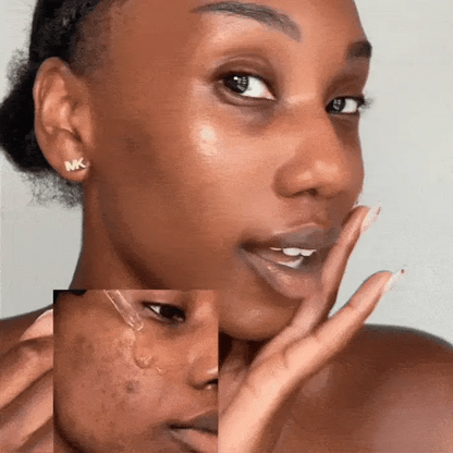 Anti-Blemish Routine