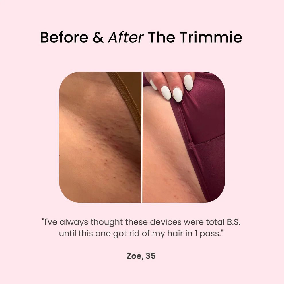 The Trimmie Unfiltered 4.0