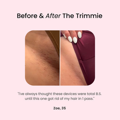 The Trimmie Unfiltered 4.0