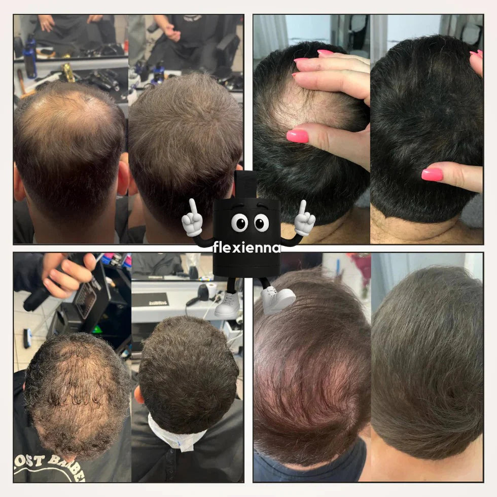 Poudre Capillaire Flexienna™ – Camouflez instantanément les zones sans cheveux