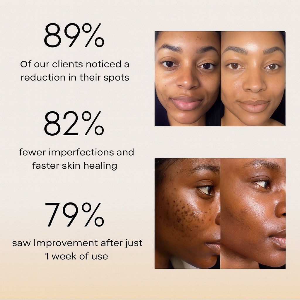 Anti-Blemish Routine