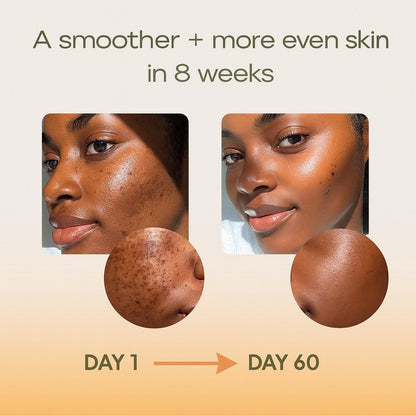 3-in-1 Anti-Blemish Serum