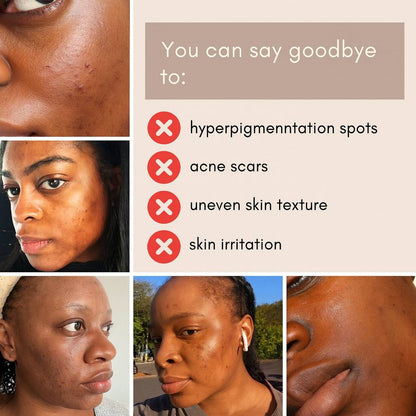 Anti-Blemish Routine