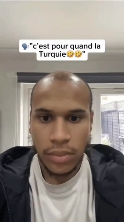 Poudre Capillaire Flexienna™ – Camouflez instantanément les zones sans cheveux